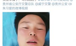 音乐人朱习爱微博发文被撞住院， 司机肇事逃逸