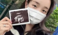 韩国著名女歌手白娥娟宣布怀孕， 宝宝性别曝光系女孩